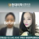 바로여다 이미지