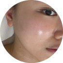 연예인 | 운정피부관리 연예인이 받는 윤곽관리 받은 후기