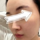 예스케어 - 유성구 | 건대 6세대필링 예스필 저자극 케어 리얼후기