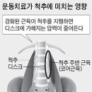 코어척추운동센터