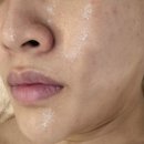 온천2동-14 | 동래피부관리 수분 리프팅 쫀쫀 물광케어 : 보에스테틱