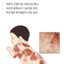 “희귀병도 서러운데”…정부, 저소득층 치료비 지원 31% 삭감 이미지