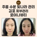 빛나라 | 김포 피부관리샵 로이나뷰티 내돈내산 빛나라 관리 후기