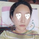 정안한의원 | 강남 동안침 정안침 한방성형 후기_20년지기 친구랑 브런치먹고 동안되기