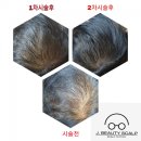 제이J스칼프