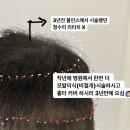 도트인스칼프 이미지