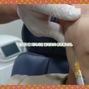 대전성형외과잘하는곳? ‘이것’만 잘 지키시면 필러로도 충분합니다.