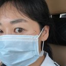 미델의원 | 대전 관저동 잡티 치료 :: 관저동 미델의원 잡티 레이저 치료 일주일 후기