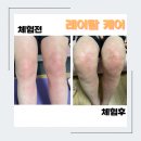 보담핏