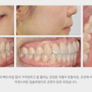 연세미소의원 이미지