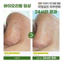 바이오헤드 이미지