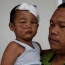 Toddler injured after falling off dad's motorcycle 이미지