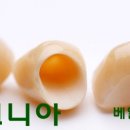 베일러연합치과 네이버블로그