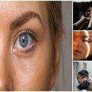 인계 블리비의원 | 인계동 피부 관리, 자연스러운 피부 광택을 위한 관리