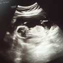 마리엠산부인과의원 이미지