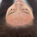 목포 헤어라인 왁싱 메이크도노로 깨끗해진 이유
