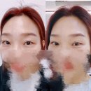 현해프라자 | 부천 상동 속눈썹펌 짧은길이도 여신 눈매 가능한 거 실화?내돈내산 솔직 후기