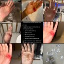 강남힘찬병원 | 모든 멋진 일에는 두려움이 따른다