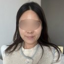 튠페이스 내돈내산 타임락튠 두번째 시술후기