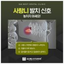 섬세한사랑니치과의원 네이버블로그