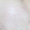 포엘메디 이미지