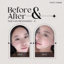 갈매역 | 구리피부관리 얼굴축소 약손명가 구리갈매역점 k-뷰티 연예인관리A 후기