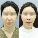 거상광고