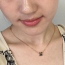 [시술후기] 촬영앞둔 예신의 입술필러 및 온다리프팅 후기