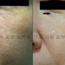 연세지움 Daum카페