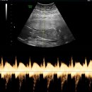 해피의원 | 16주차 임신 기록 / 서브 병원 해피맘 산부인과 후기 / 젠더리빌 이벤트