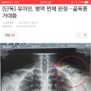 유아인, 병역 면제 판정…골육종 거대화 이미지