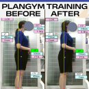 은평아이디의원 | 구파발pt 목 통증,라운드 숄더 개선*플랜짐 실제 회원님 사례*