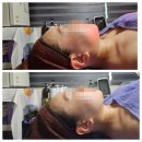 신안2차APT경로당 | 문래피부관리 영등포 작은얼굴 윤곽관리 은S스킨바디