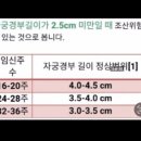 묵선방 | @ 임신23주~25주차 일상 (제주도 태교여행 / 코피 이슈 / 임당검사 / 제1회 회사 공동육아 / 자궁경부...
