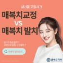 강동본치과의원 | 성내동 교정치과 매복치교정 vs 매복치발치, 어떤 치료가 필요할까요?