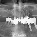 수자인치과의원 네이버블로그