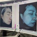 노원역 기미치료 잘하는 한의원 내돈내산 1회차 후기