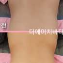 에이치바디케어 이미지