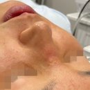 서울피부과추천? 후기 함부로 믿지 마세요. &lt;의사 폭로&gt;