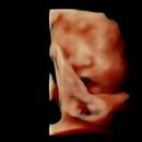 라움메디 | 평택 서울유산부인과 초음파 후기 입체초음파 급여적용 저렴한곳 방문