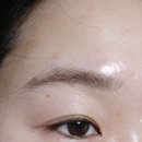 금천구 붉은 눈썹잔흔제거 잘하는 누니아 1회차 후기