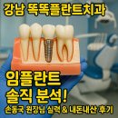 똑똑플란트치과의원 | 🦷 강남 똑똑플란트치과 임플란트 솔직 분석! 손동국 원장님 실력 &amp; 내돈내산 후기 팩트체크 (주차...