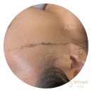 [의정부]호원동 묵은각질관리+모공관리 한번에 받을 수 있는 스킨플래닝 잘하는 곳 &#34;제이수뷰티&#34; 방문후기