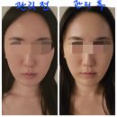 미소케어 | HN스파 코리아나호텔점 광화문 스파 동안미소 + 숏케어 후기