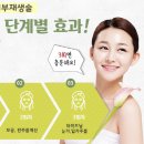 몽고반점 이미지
