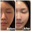 바른코스메디컬 | 해운대 피부관리 추천｜더함에스테틱 ‘피오니 리커버리 케어’ 후기