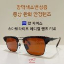 W메디컬 | 망막색소변성증 증상 완화 안경렌즈 / 칼 자이스 스마트라이프 인디비주얼3 단초점 메디컬렌즈
