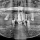 의왕퍼스트치과의원 이미지