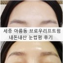 바비수 - 청주시 흥덕구 | 세종 아름동 브로우리프트펌 내돈내산 눈썹펌 시술 후기