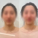 W-11. 대구 신부관리 / 윤곽관리 / 드레스라인관리 죽전동 매끄롬 강력추천 후기 (내돈내산)